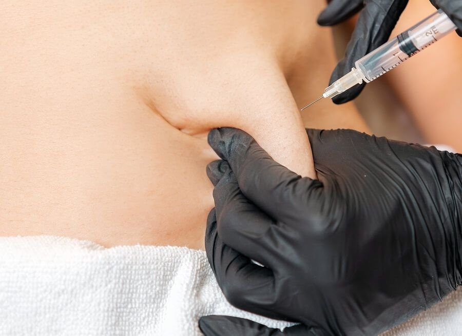 tummy fat injection